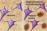 neurone-large
